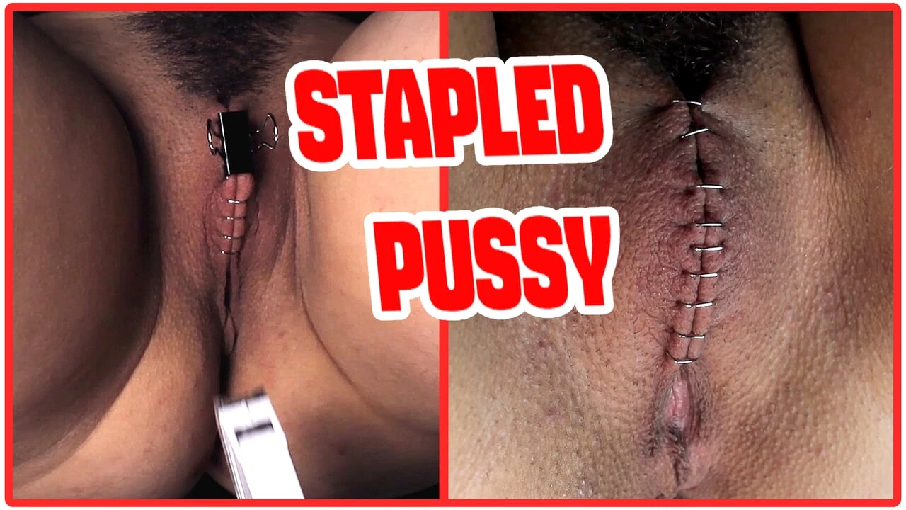 Sadistic doctor closes and staples his patient’s pussy